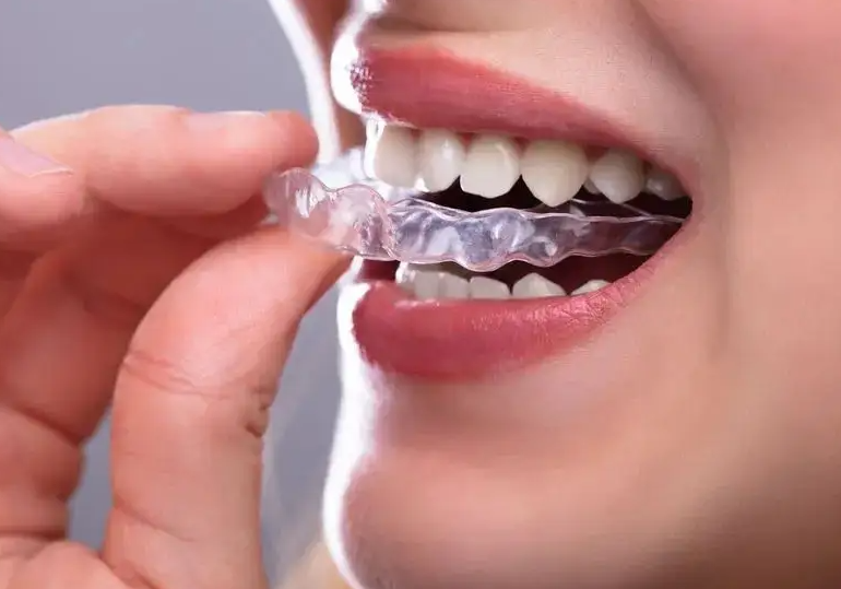 Top 5 Best Teeth Covers of 2023 (Reviews)